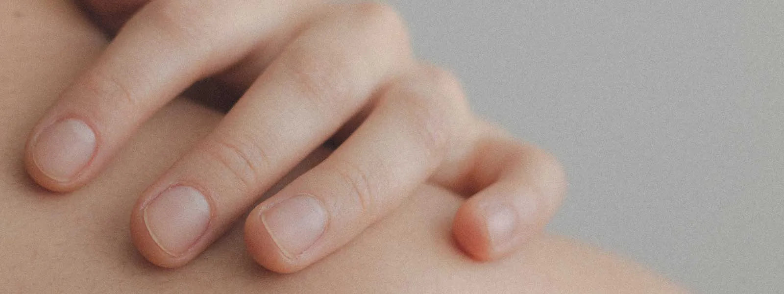skin supplements